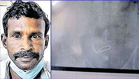 പ്രതി സിദ്ധിഖും, പാദസരം വയറ്റിൽ കിടക്കുന്ന എക്സ്റേ ചിത്രവും