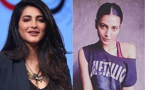 'ഞാൻ പ്ലാസ്റ്റിക് സർജറി ചെയ്തിട്ടുണ്ട്, അത് തുറന്നുപറയാൻ ഒട്ടും നാണക്കേടില്ല'; വികാരഭരിതയായി ശ്രുതി ​ഹാസൻ 