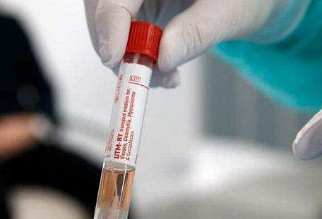 പൊലീസിനെ ആക്രമിച്ച മൂന്ന് പേര്‍ക്ക് കോവിഡ്‌; ജയിലിലും ആശങ്ക ; തടവുകാരും പൊലീസുകാരും നിരീക്ഷണത്തിൽ