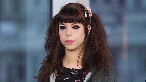 കണ്ണിന്റെ നിറം മാറ്റാൻ ടാറ്റു: അസഹ്യമായ വേദന, കാഴ്ച പൂർണമായും നഷ്ടപ്പെട്ടു; പരാതിയുമായി മോഡൽ 