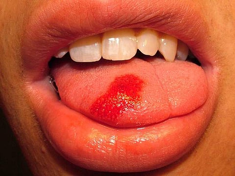 പ്രതീകാത്മകചിത്രം