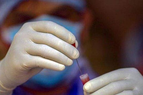 ഒരു മണിക്കൂറിൽ ഫലം; ചെലവും കുറവ്; കൊറോണ വൈറസ് പരിശോധനയ്ക്ക് ഐജിഐബിയുടെ 'ഫെലൂദ'