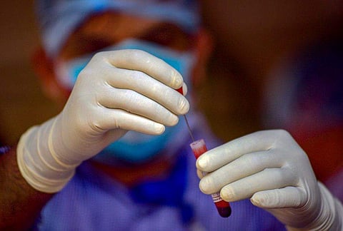 4500 രൂപ മുടക്കി ഒരു ടെസ്റ്റ് കിറ്റും വാങ്ങിയിട്ടില്ല, പിസിആര്‍ ടെസ്റ്റ് കിറ്റിന് പരമാവധി വില 1150 രൂപ, റാപ്പിഡ് ടെസ്റ്റിന് 528- 795; വിശദീകരണവുമായി ഐസിഎംആര്‍