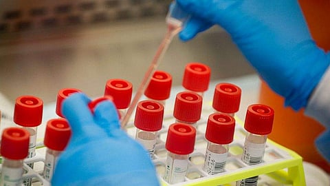 കോവിഡ് 19: റാപ്പിഡ് ടെസ്റ്റ് നടത്തുന്നത് ആരിലെല്ലാം? രജിസ്‌ട്രേഷന്‍ എങ്ങനെ? വിശദാംശങ്ങള്‍