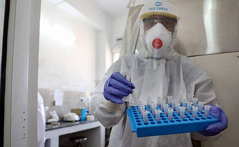 രാജ്യത്തെ കോവിഡ് കേസുകള്‍ 78,000 കടന്നു; 24 മണിക്കൂറിനുള്ളില്‍ 3722പേര്‍ക്ക് രോഗബാധ; മരിച്ചത് 134പേര്‍, ആകെ മരണം 2549