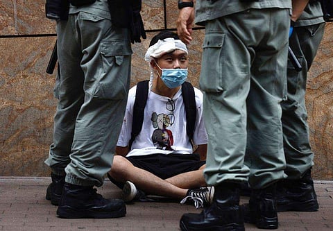 കോവിഡ് ബാധിതര്‍ 57 ലക്ഷം കടന്നു; കവര്‍ന്നത് മൂന്നരലക്ഷത്തിലധികം ജീവനുകള്‍ 