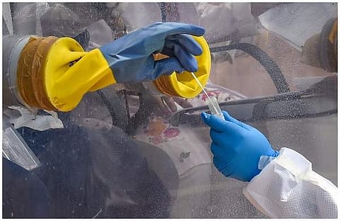 ശുക്ലത്തില്‍ വൈറസ്; ലൈംഗിക ബന്ധത്തിലൂടെ കോവിഡ് പടരുമോ?; പഠന റിപ്പോര്‍ട്ട്