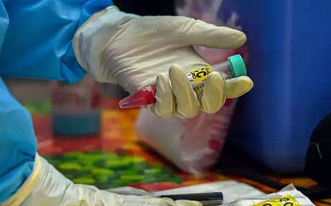 കോവിഡ് നിരീക്ഷണത്തിലായിരുന്ന മലപ്പുറം സ്വദേശിനി മരിച്ചു; സ്രവം പരിശോധനയ്ക്ക് അയച്ചു 