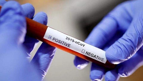 പ്രതിരോധ സെക്രട്ടറി അജയ് കുമാറിന് കോവിഡ്, പ്രതിരോധ മന്ത്രാലയത്തിലെ 35 ജീവനക്കാര്‍ ക്വാറന്റൈനില്‍