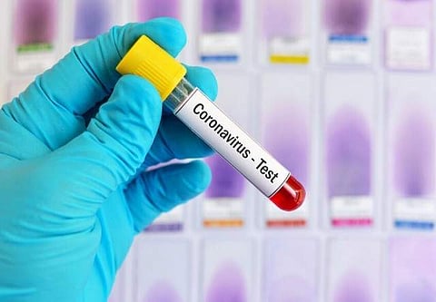 തവിഞ്ഞാലില്‍ 42 പേര്‍ക്ക് കൂടി കോവിഡ് ; വയനാട്ടില്‍ ആശങ്കയേറുന്നു