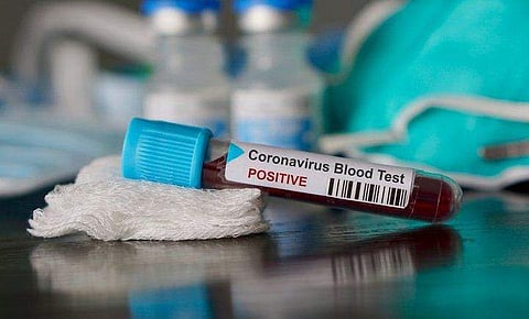 പിറവത്ത് ഒരു വീട്ടിലെ നാലു പേർക്ക് കോവിഡ് ; സമൂഹവ്യാപനം തടയാൻ നിയന്ത്രണങ്ങൾ കടുപ്പിക്കുന്നു