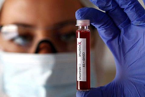 പരിശോധനയില്‍ നെഗറ്റിവ്; പതിമൂന്നുകാരിയില്‍നിന്നു കോവിഡ് പകര്‍ന്നത് 11 ബന്ധുക്കള്‍ക്ക് 