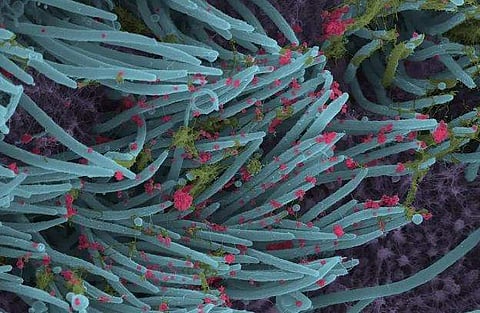 കൊറോണ വൈറസിന്റെ ചിത്രങ്ങളെടുത്ത് ​ഗവേഷകർ