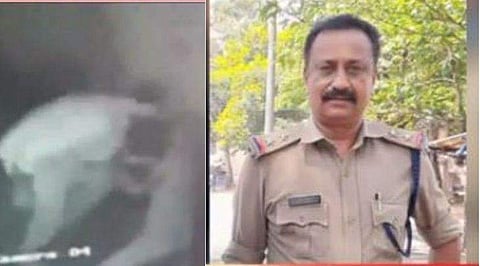 വിദ്യാര്‍ത്ഥിയെ മര്‍ദ്ദിച്ച ഗുണ്ടാനേതാവിന് സ്റ്റേഷന്‍ ജാമ്യം: എസ്‌ഐക്ക് സസ്‌പെന്‍ഷന്‍; വകുപ്പുതല അന്വേഷണം