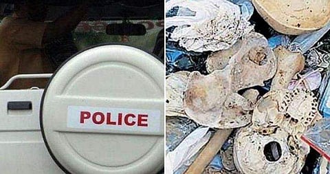 വീട്ടുപറമ്പില്‍ മാലിന്യങ്ങള്‍ക്കൊപ്പം അസ്ഥികൂടം, മെഡിക്കല്‍ പഠനത്തിന് ഉപയോഗിച്ചതാകാമെന്ന് പൊലീസ്‌