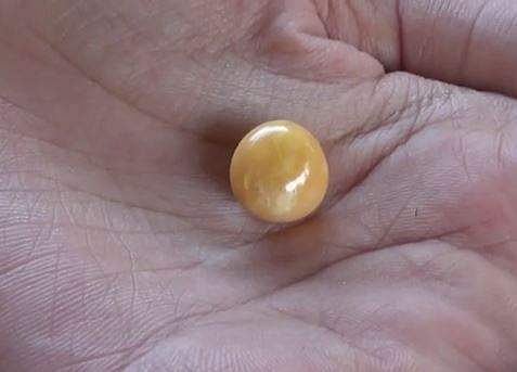 ഒച്ചിന്റെ ഉള്ളില്‍ നിന്ന് കണ്ടെടുത്ത മൂല്യമേറിയ പവിഴം