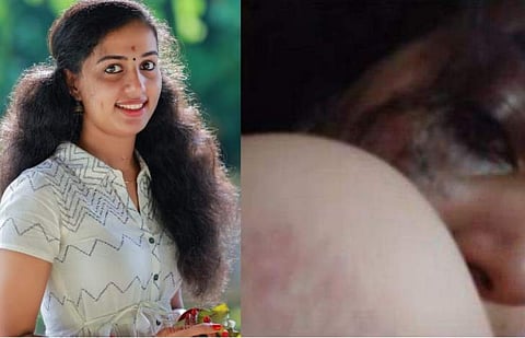 മരിച്ച വിസ്മയ, മർദനമേറ്റ ചിത്രങ്ങൾ / ടെലിവിഷൻ ചിത്രം