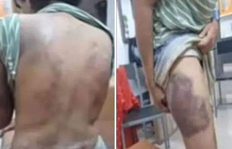 ടെലിവിഷന്‍ ദൃശ്യം