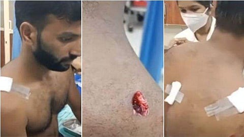 കടുവയുടെ ആക്രമണത്തില്‍ പരിക്കേറ്റ ഹുസൈന്‍ / ടെലിവിഷന്‍ ചിത്രം