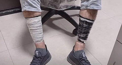 സ്വര്‍ണമിശ്രിതം കാലില്‍ കെട്ടിവെച്ച നിലയില്‍ / ടെലിവിഷന്‍ ചിത്രം