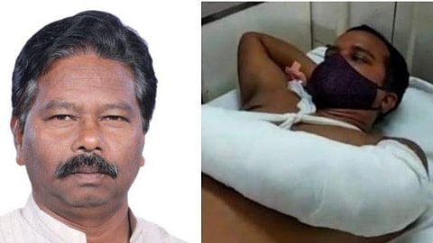 കേന്ദ്ര മന്ത്രി ബിശ്വേശ്വർ ടുഡു, പരിക്കേറ്റ ഉദ്യോ​ഗസ്ഥൻ/ ഫോട്ടോ: ട്വിറ്റർ