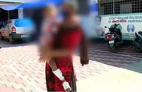 പൊള്ളലേൽപ്പിച്ച കുഞ്ഞുമായി അമ്മ