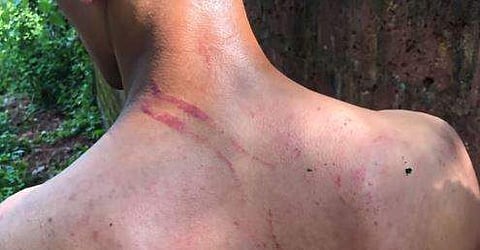 റാഗിങ്ങില്‍ വിദ്യാര്‍ഥിക്ക് മര്‍ദ്ദനമേറ്റ പാടുകള്‍, സ്‌ക്രീന്‍ഷോട്ട്‌