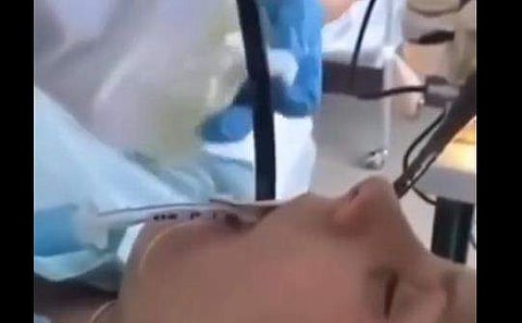 വായിലൂടെ അകത്തുകയറിയ പാമ്പിനെ പുറത്തെടുക്കുന്ന ദൃശ്യം