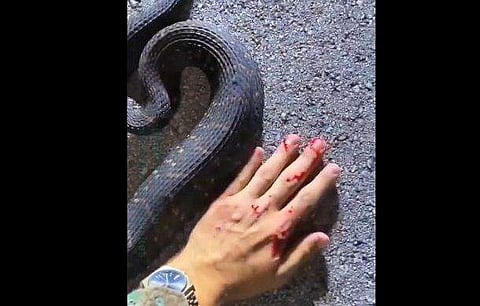 കൈയില്‍ പാമ്പ് കടിച്ച നിലയില്‍