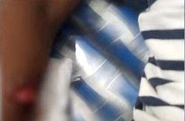 ഒന്‍പത് വയസുകാരന്റെ കൈയില്‍ തെരുവുനായ കടിച്ചനിലയില്‍