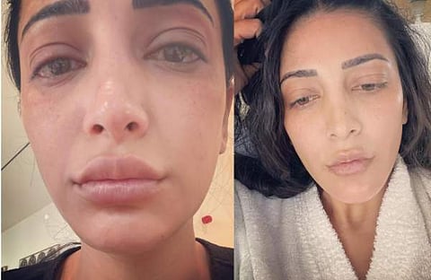 ശ്രുതി ഹാസൻ ഇൻസ്റ്റ​ഗ്രാമിൽ പങ്കുവച്ച ചിത്രങ്ങൾ