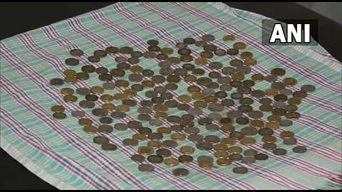 58കാരന്റെ വയറ്റില്‍ നിന്ന് പുറത്തെടുത്ത 187 നാണയങ്ങള്‍, എഎന്‍ഐ