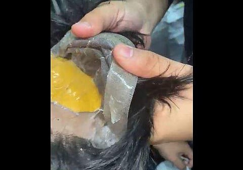 വിഗ്ഗിനുള്ളില്‍ ഒളിപ്പിച്ച നിലയില്‍ സ്വര്‍ണം/ വീഡിയോ ദൃശ്യം