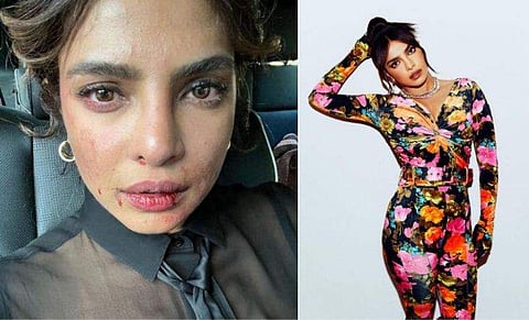 ചിത്രം; ഇൻസ്റ്റ​ഗ്രാം