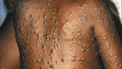 ഫയല്‍ ചിത്രം