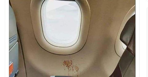 വിമാനത്തില്‍ മുറുക്കി തുപ്പിയ നിലയില്‍