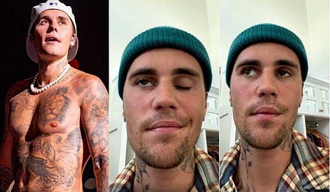 ചിത്രം; ഇൻസ്റ്റ​ഗ്രാം