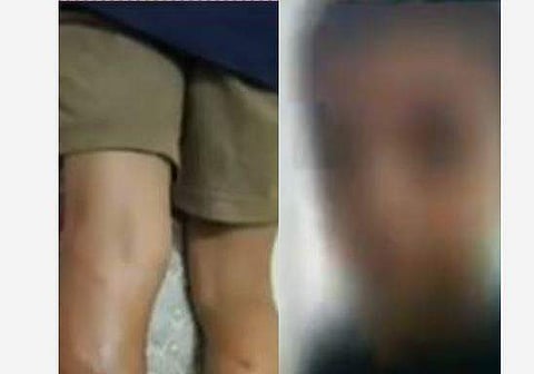 പരിക്കേറ്റ കുട്ടി/ ടെലിവിഷന്‍ ചിത്രം