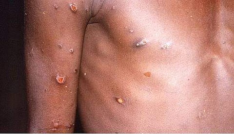 പ്രതീകാത്മക ചിത്രം