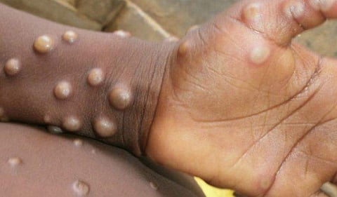 ഫോട്ടോ: ട്വിറ്റർ