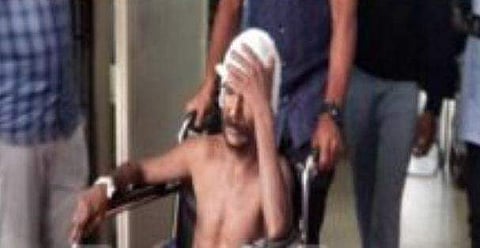 കരടി ആക്രമിച്ച കുഞ്ഞന്‍