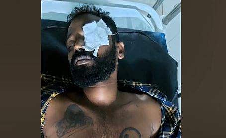 പൊലീസ് മര്‍ദ്ദനത്തില്‍ പരിക്കേറ്റ ജസ്റ്റിന്‍