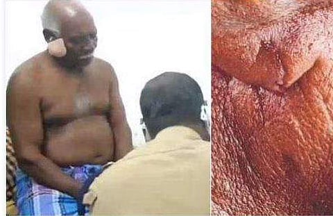 പരിക്കേറ്റ സെബാസ്റ്റ്യന്‍/ ടിവി ദൃശ്യം