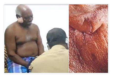 പരിക്കേറ്റ സെബാസ്റ്റ്യന്‍/ ടിവി ദൃശ്യം