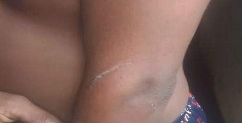 14കാരന്റെ ദേഹത്തെ മര്‍ദ്ദനമേറ്റ പാട്, സ്‌ക്രീന്‍ഷോട്ട്‌