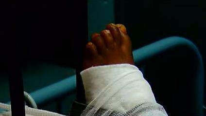 12കാരന്റെ കാലിന്റെ എല്ല് പൊട്ടിയ നിലയില്‍, സ്‌ക്രീന്‍ഷോട്ട്