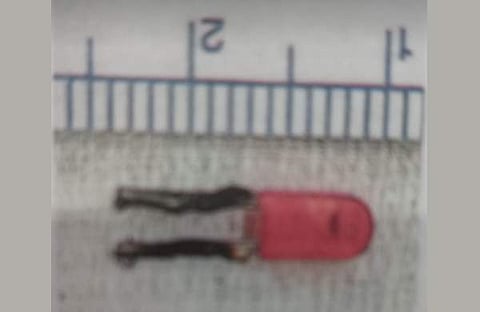 കുഞ്ഞിന്റെ ശ്വാസകോശത്തിൽ നിന്നും നീക്കം ചെയ്ത ബൾബ്