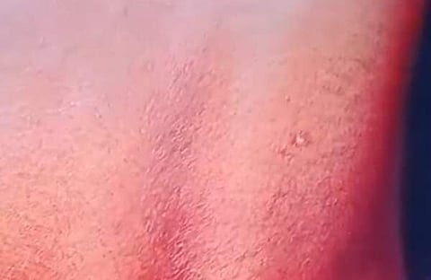 കുട്ടിയുടെ ദേഹത്തെ പരിക്കേറ്റ പാട്, സ്ക്രീൻഷോട്ട്