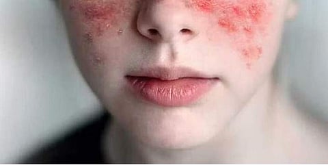 പ്രതീകാത്മക ചിത്രം