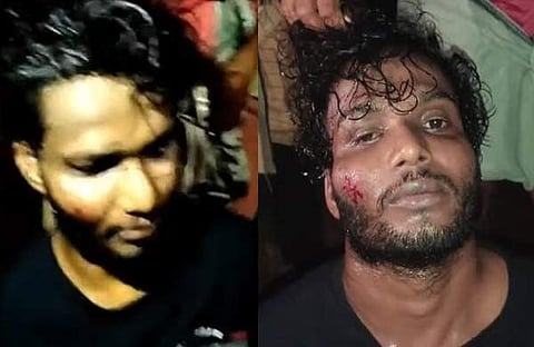 പരിക്കേറ്റ സന്തോഷ്/ ടിവി ദൃശ്യം